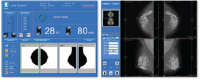 Photo Leasing BEMEMS Pinkview-DR PLUS Mammographe - 2